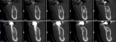 Coupes fdja60 - Eugenol
