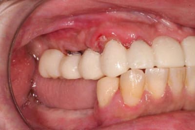 Crepin 009 zas1ax - Eugenol