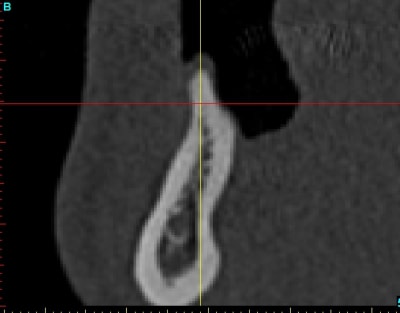 Cross section dhvkc8 - Eugenol