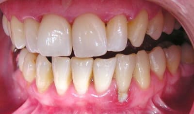 Début tr1 jk6ge3 - Eugenol