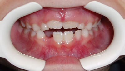 D3 dyfp2i - Eugenol