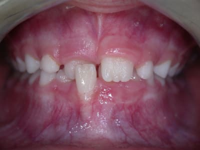 D but ilq2eg - Eugenol