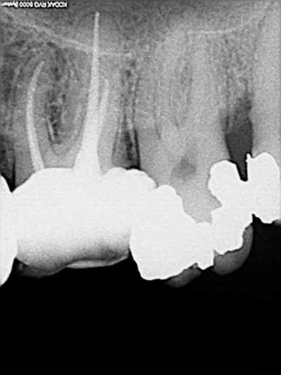 Dac2 ymwxen - Eugenol