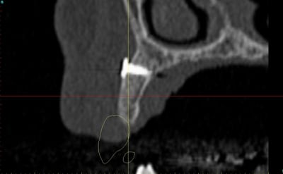 Dar13 alznrp - Eugenol