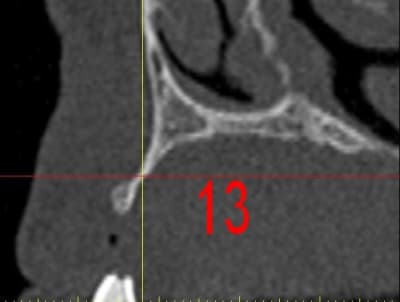 Dar13 daauc7 - Eugenol