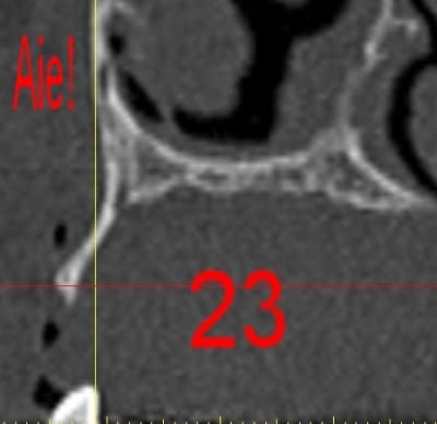 Dar23a qejgm5 - Eugenol