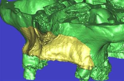 Dar 3d1 iido9a - Eugenol