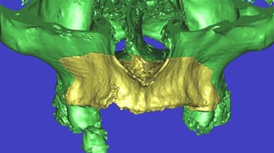 Dar 3d2 dlhwj3 - Eugenol