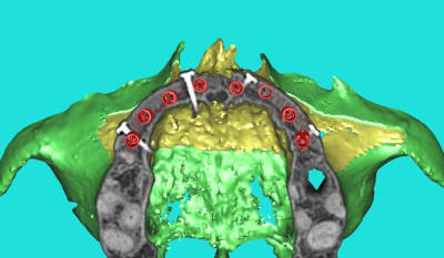 Dar  3di ngfcc4 - Eugenol