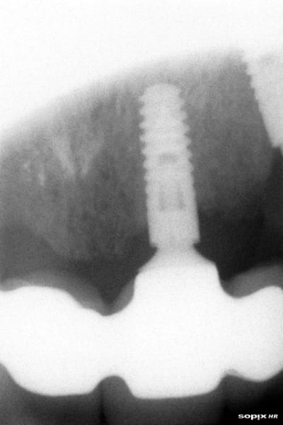 Dec2009 nooyhh - Eugenol