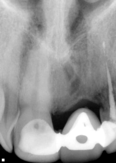 Dent 22 x3bp9b - Eugenol