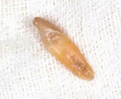 Dent nettoyee hd9rhq - Eugenol