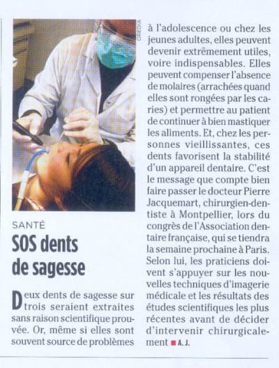 Dents de sagesse nlbmvb - Eugenol