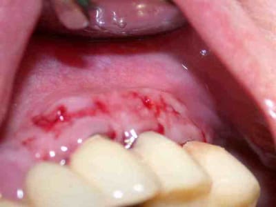Depose points dn1eh3 - Eugenol