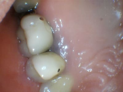 Det8qbxm5o0t6ffs3laq - Eugenol