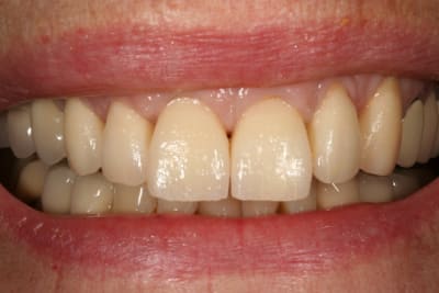 Deuxi me essai biscuit djcjcj - Eugenol