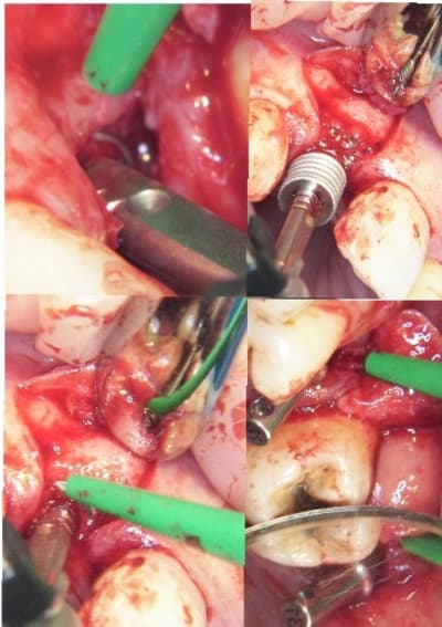 Dia5 s4uvmn - Eugenol