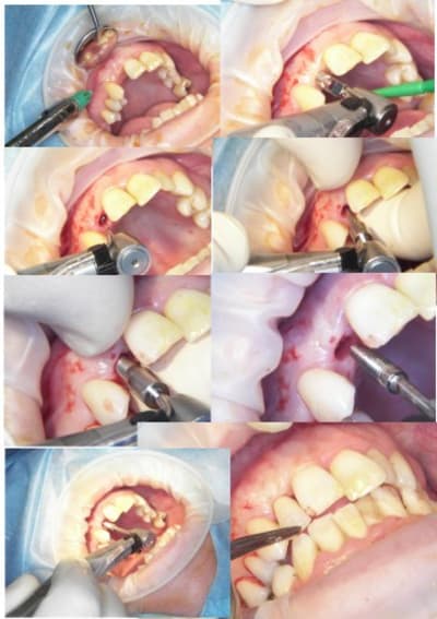 Dia zyjuwk - Eugenol