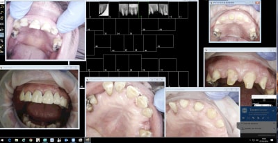 Dljvow7xmz1g8twwtqgs - Eugenol