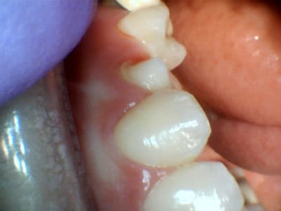 Dncwnhtbshjtclfqzluo - Eugenol