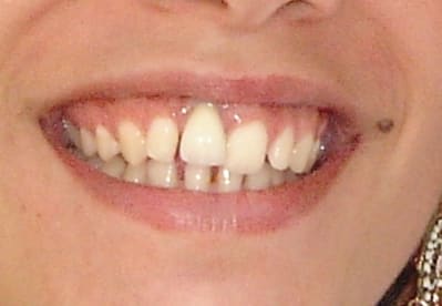 Dniioaf43h9tjtit6lme - Eugenol