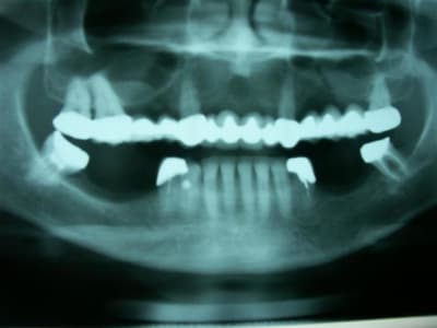 Do brasiu nphp0g - Eugenol