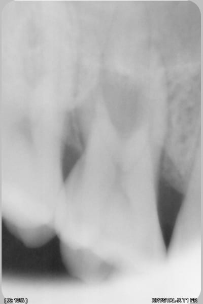 Dr1pfvhpbcu9sokm4njr7p297r37 - Eugenol