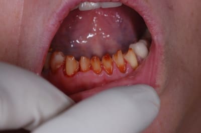Dubesset  7  fvtlha - Eugenol