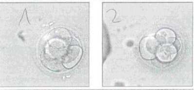 Emb2 ucqkia - Eugenol