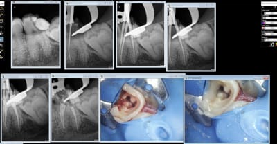 Endo 37 1 xnn3zg - Eugenol