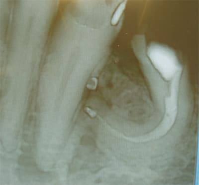 Endo vjzkps - Eugenol