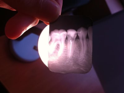 Endomarion c605cj - Eugenol