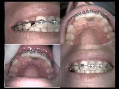 Espace presque bon drm0e3 - Eugenol