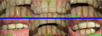 Eug05 pmri po fctel i9xupy - Eugenol