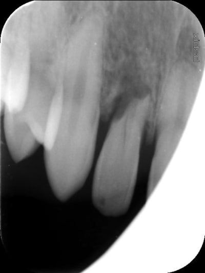Eugenol re tro grzvrj - Eugenol
