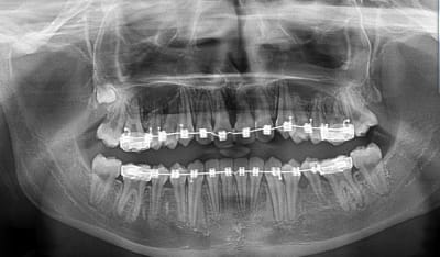Eunju2n7fnwiz1tchifa - Eugenol
