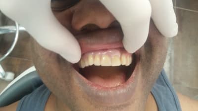 Ewc4jookw5yh0lrt2som - Eugenol