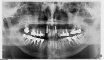 Exemple t4qmlu - Eugenol