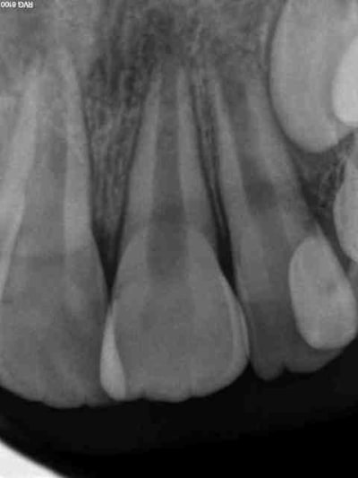 Extrusion j 50jrs h8j2aa - Eugenol