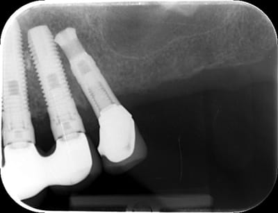 Ey005oghnwm7xvsmbu5v - Eugenol