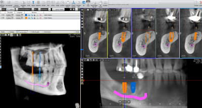 Ezxnyl938g3pngplvev1 - Eugenol