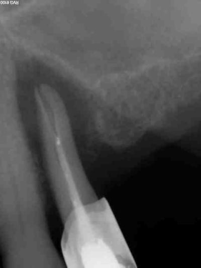 F lure lkajz1 - Eugenol