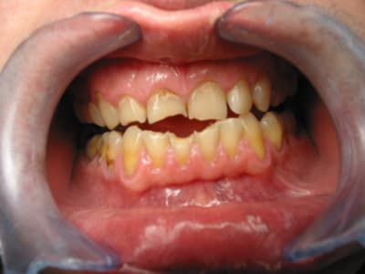 Face2 nbzo55 - Eugenol