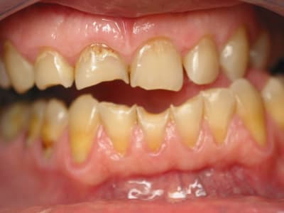 Face adk7td - Eugenol