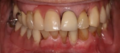 Face f3cuct - Eugenol