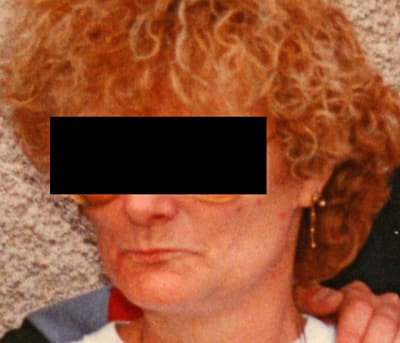 Face jeune juso2n - Eugenol