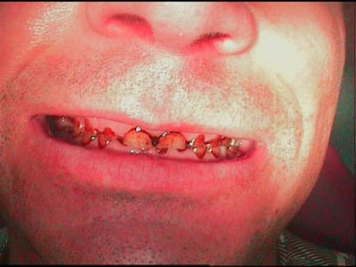 Face qvzkdz - Eugenol