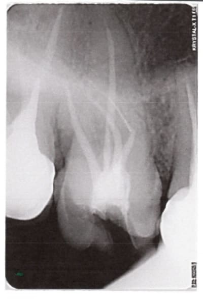 Fauxcanalavoir0 yszo1r - Eugenol