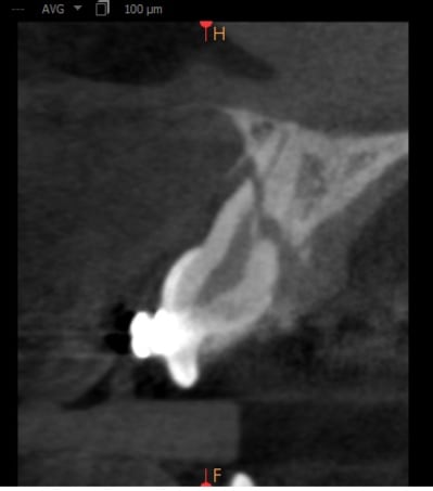 Fefssyo57ohgp8nwrrqo - Eugenol