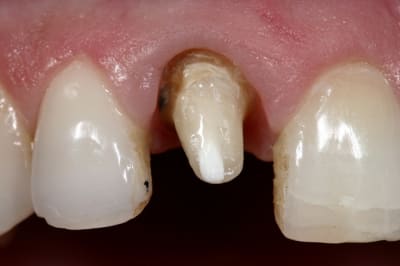 Figure 6 renw0o - Eugenol